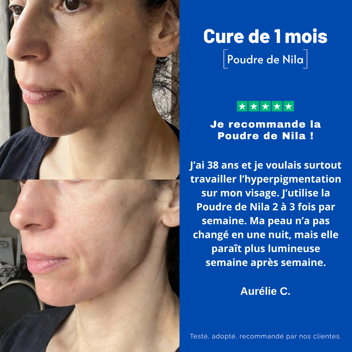 Poudre de Nila Pure – Anti-Taches / Hyperpigmentation